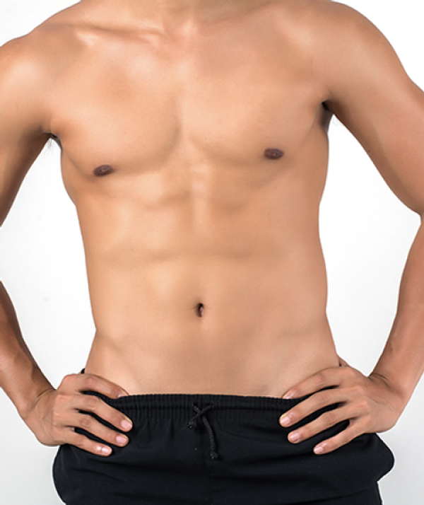 Gynecomasty